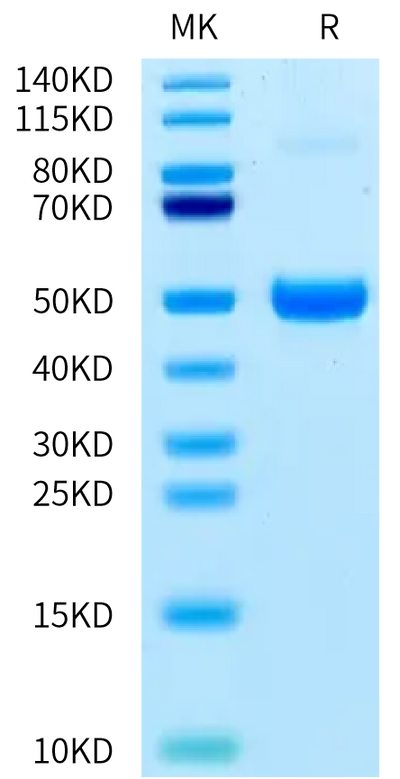 Human ACVR1B on Bis-Tris PAGE under reduced condition. The purity is greater than 95%.Recombinant Human ACVR1B/Activin RIB Protein, Active
