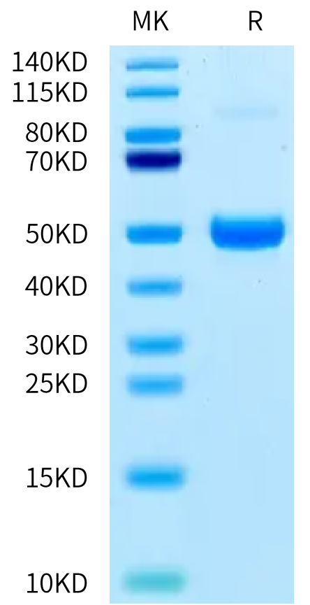 Human ACVR1B on Bis-Tris PAGE under reduced condition. The purity is greater than 95%.Recombinant Human ACVR1B/Activin RIB Protein, Active