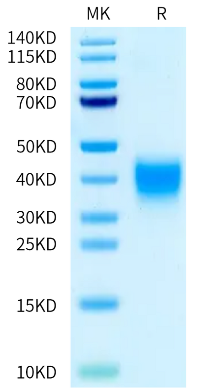 Rat Activin RIIA on Bis-Tris PAGE under reduced condition. The purity is greater than 95%.Recombinant Rat Activin RIIA/ACVR2A Protein, Active