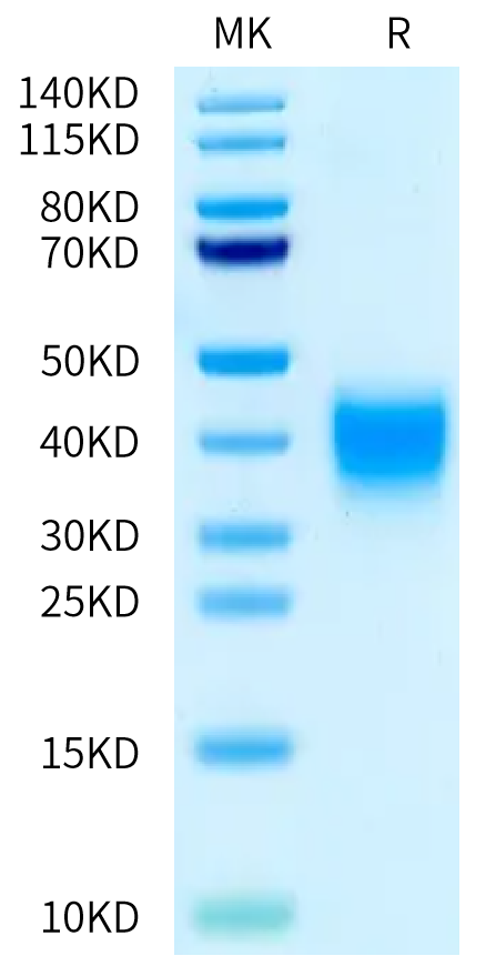 Rat Activin RIIA on Bis-Tris PAGE under reduced condition. The purity is greater than 95%.Recombinant Rat Activin RIIA/ACVR2A Protein, Active