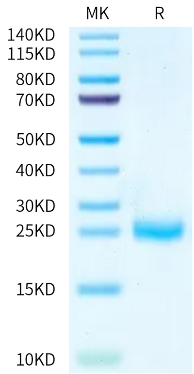 Mouse IL-2 on Bis-Tris PAGE under reduced condition. The purity is greater than 95%.Recombinant Mouse IL-2 Protein