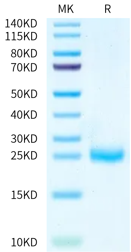 Mouse IL-2 on Bis-Tris PAGE under reduced condition. The purity is greater than 95%.Recombinant Mouse IL-2 Protein