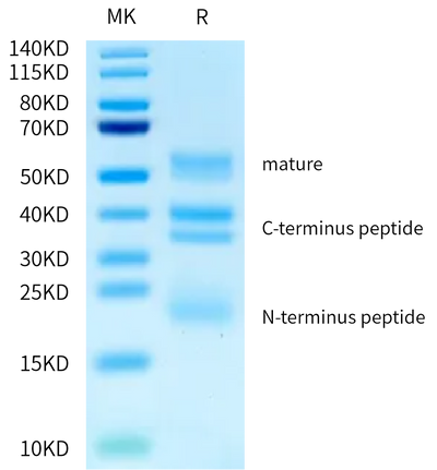 Biotinylated Human RGM-C on Bis-Tris PAGE under reduced condition. The purity is greater than 95%.Biotinylated Human RGM-C Protein, Active