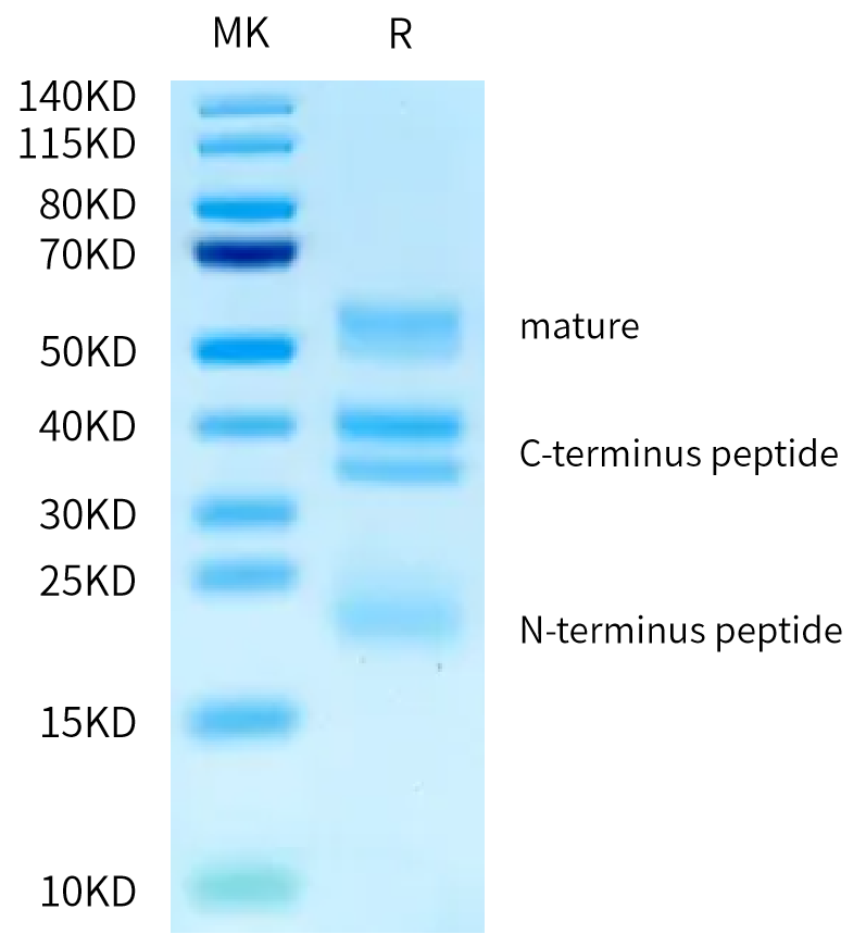 Biotinylated Human RGM-C on Bis-Tris PAGE under reduced condition. The purity is greater than 95%.Biotinylated Human RGM-C Protein, Active