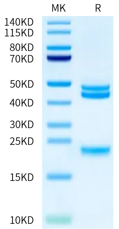 Cynomolgus IL-23 alpha&IL-12 beta on Bis-Tris PAGE under reduced condition. The purity is greater than 95%.Recombinant Cynomolgus IL-23 alpha&IL-12 beta Protein, Active