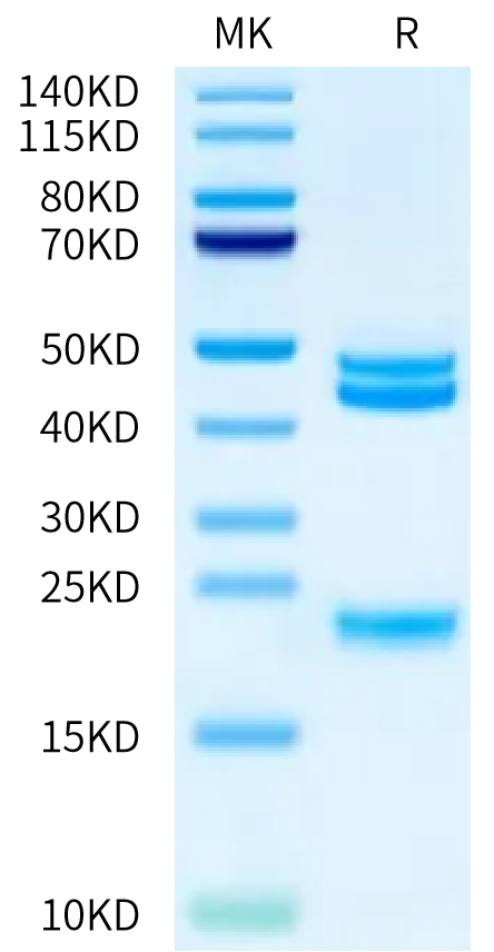 Cynomolgus IL-23 alpha&IL-12 beta on Bis-Tris PAGE under reduced condition. The purity is greater than 95%.Recombinant Cynomolgus IL-23 alpha&IL-12 beta Protein, Active