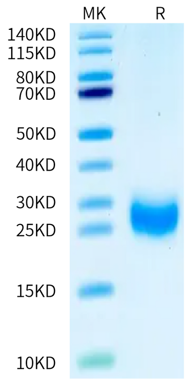 Human VEGF-D on Bis-Tris PAGE under reduced condition. The purity is greater than 95%.Recombinant Human VEGF-D Protein, Active