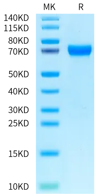 Human Musk (muscle, skeletal receptor tyrosine-protein kinase) on Bis-Tris PAGE under reduced condition. The purity is greater than 95%.Recombinant Human Musk (muscle, skeletal receptor tyrosine-protein kinase) Protein