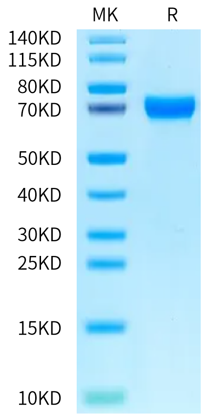 Human Musk (muscle, skeletal receptor tyrosine-protein kinase) on Bis-Tris PAGE under reduced condition. The purity is greater than 95%.Recombinant Human Musk (muscle, skeletal receptor tyrosine-protein kinase) Protein