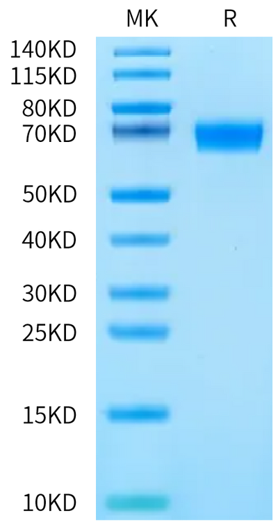 Mouse Musk (muscle, skeletal receptor tyrosine-protein kinase) on Bis-Tris PAGE under reduced condition. The purity is greater than 95%.Recombinant Mouse Musk (muscle, skeletal receptor tyrosine-protein kinase) Protein