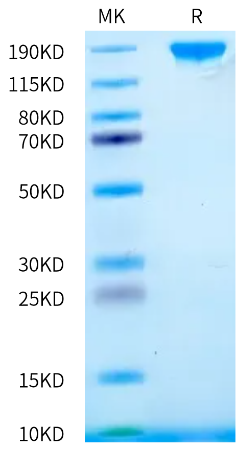 Rat SEZ6 on Bis-Tris PAGE under reduced condition. The purity is greater than 95%.Recombinant Rat SEZ6 Protein, Active