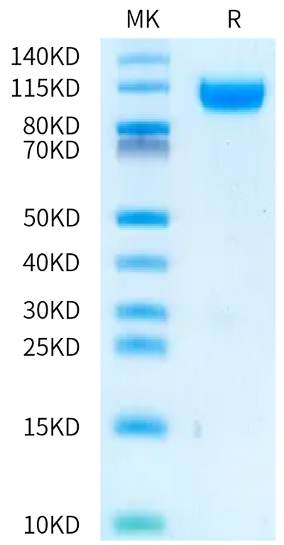 Rat IL-23R on Bis-Tris PAGE under reduced condition. The purity is greater than 95%.Recombinant Rat IL-23R Protein, Active