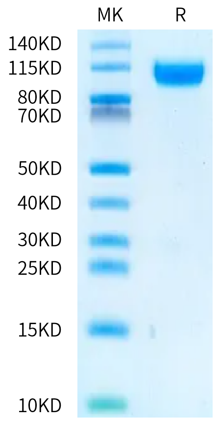 Rat IL-23R on Bis-Tris PAGE under reduced condition. The purity is greater than 95%.Recombinant Rat IL-23R Protein, Active