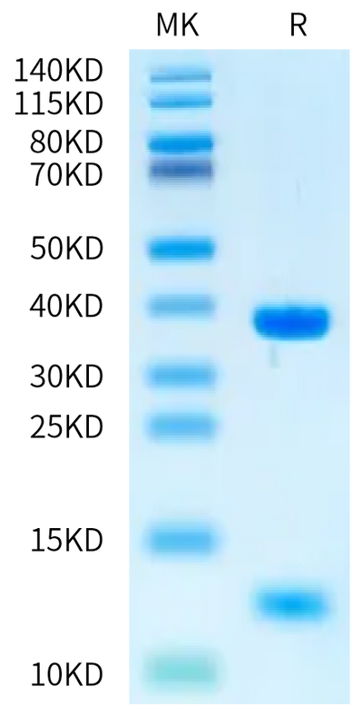Human MICB*014:01:08 on Bis-Tris PAGE under reduced condition. The purity is greater than 95%.Recombinant Human MICB*014:01:08 Protein, Active