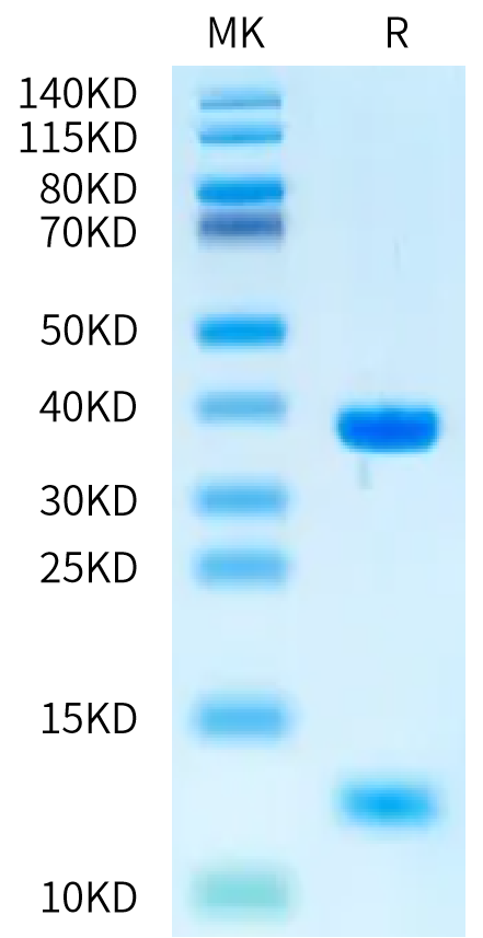 Human MICB*014:01:08 on Bis-Tris PAGE under reduced condition. The purity is greater than 95%.Recombinant Human MICB*014:01:08 Protein, Active