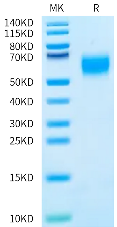 Human MICA*012:08 on Bis-Tris PAGE under reduced condition. The purity is greater than 95%.Recombinant Human MICA*012:08 Protein, Active