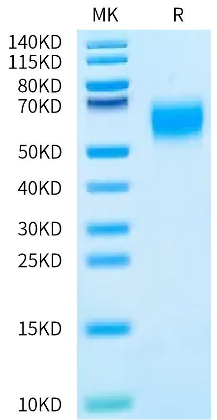 Human MICA*012:08 on Bis-Tris PAGE under reduced condition. The purity is greater than 95%.Recombinant Human MICA*012:08 Protein, Active