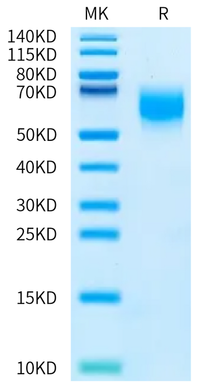 Human MICA*004:01:06 on Bis-Tris PAGE under reduced condition. The purity is greater than 95%.Recombinant Human MICA*004:01:06 Protein, Active