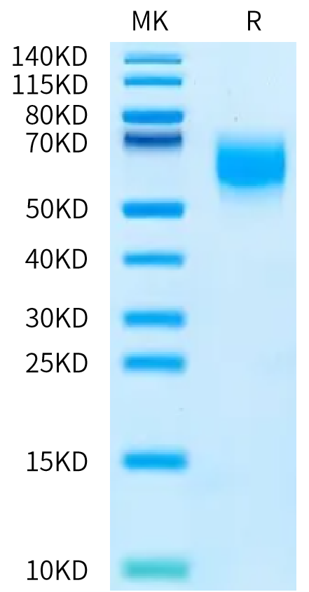 Human MICA*004:01:06 on Bis-Tris PAGE under reduced condition. The purity is greater than 95%.Recombinant Human MICA*004:01:06 Protein, Active