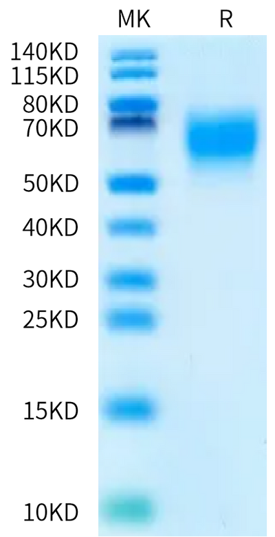 Human MICA*009:01:11 on Bis-Tris PAGE under reduced condition. The purity is greater than 95%.Recombinant Human MICA*009:01:11 Protein, Active