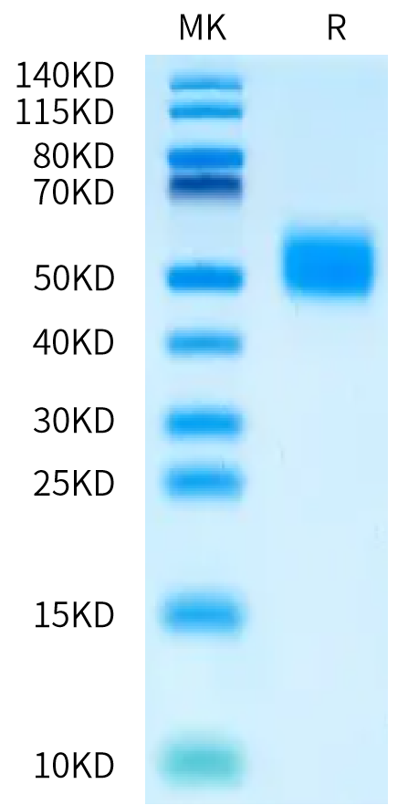 Human MICB*005:02:15 on Bis-Tris PAGE under reduced condition. The purity is greater than 95%.Recombinant Human MICB*005:02:15 Protein, Active