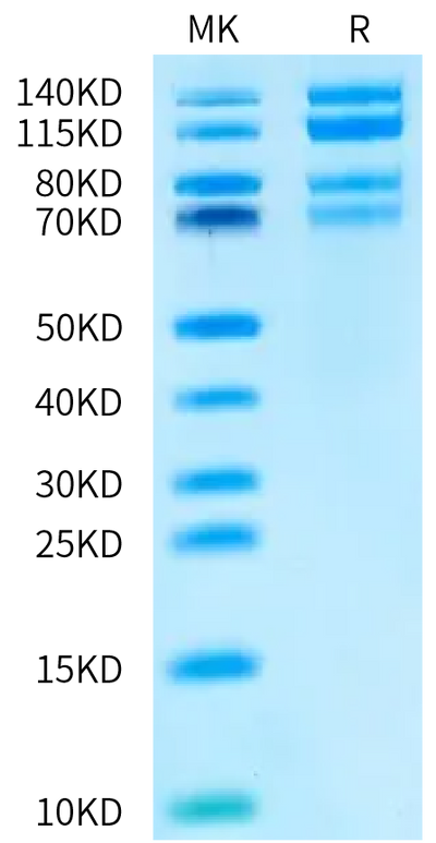 Human ITGA4&ITGB7 on Bis-Tris PAGE under reduced conditions. The purity is greater than 95%.Recombinant Human Integrin alpha 4 beta 7 (ITGA4&ITGB7) Heterodimer Protein, Active