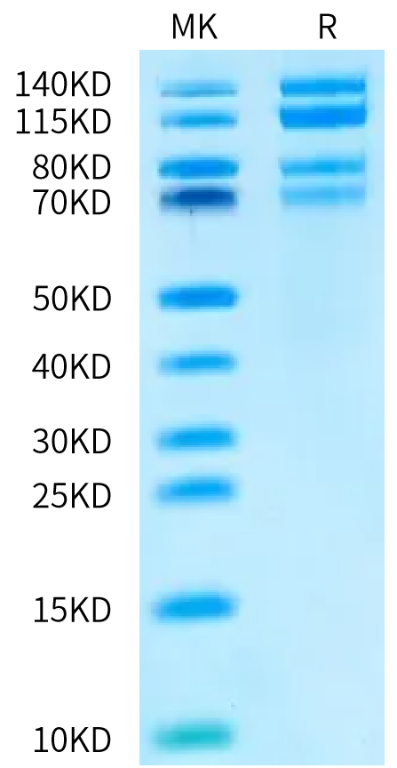 Human ITGA4&ITGB7 on Bis-Tris PAGE under reduced conditions. The purity is greater than 95%.Recombinant Human Integrin alpha 4 beta 7 (ITGA4&ITGB7) Heterodimer Protein, Active