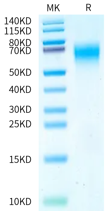 Human MICA*002:01:04 on Bis-Tris PAGE under reduced condition. The purity is greater than 95%.Recombinant Human MICA*002:01:04 Protein, Active