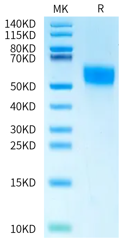 Human MICB*008:01:08 on Bis-Tris PAGE under reduced condition. The purity is greater than 95%.Recombinant Human MICB*008:01:08 Protein, Active