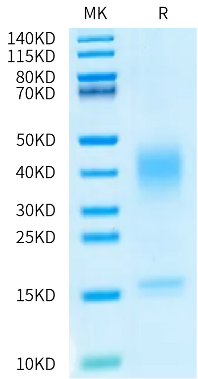 Canine IL-13 on Bis-Tris PAGE under reduced condition. The purity is greater than 95%.Recombinant Canine IL-13 Protein, Active