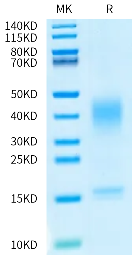 Canine IL-13 on Bis-Tris PAGE under reduced condition. The purity is greater than 95%.Recombinant Canine IL-13 Protein, Active