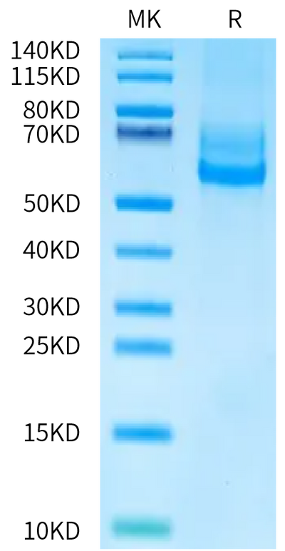 Human CD300d on Bis-Tris PAGE under reduced condition. The purity is greater than 95%.Recombinant Human CD300d Protein