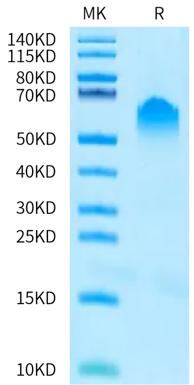 Human PVRIG on Bis-Tris PAGE under reduced condition. The purity is greater than 95%.Recombinant Human PVRIG Protein, Active