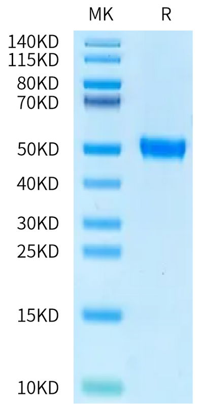Human RGM-C Domain on Bis-Tris PAGE under reduced condition. The purity is greater than 95%.Recombinant Human RGM-C Domain Protein, Active