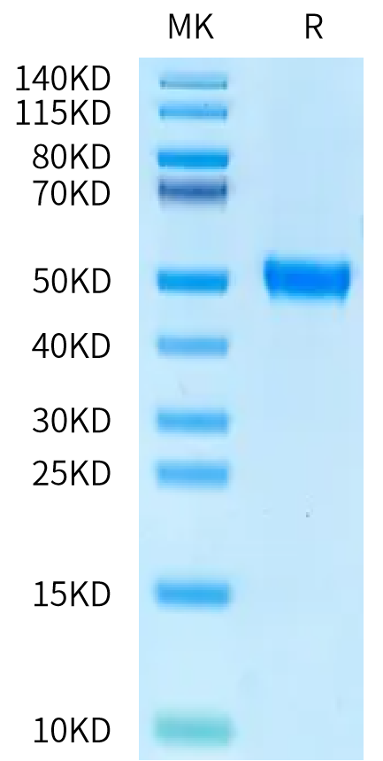 Human RGM-C Domain on Bis-Tris PAGE under reduced condition. The purity is greater than 95%.Recombinant Human RGM-C Domain Protein, Active