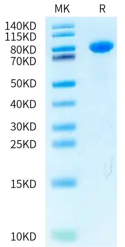 Rabbit Coagulation factor XI on Bis-Tris PAGE under reduced condition. The purity is greater than 95%.Recombinant Rabbit Coagulation factor XI Protein, Active