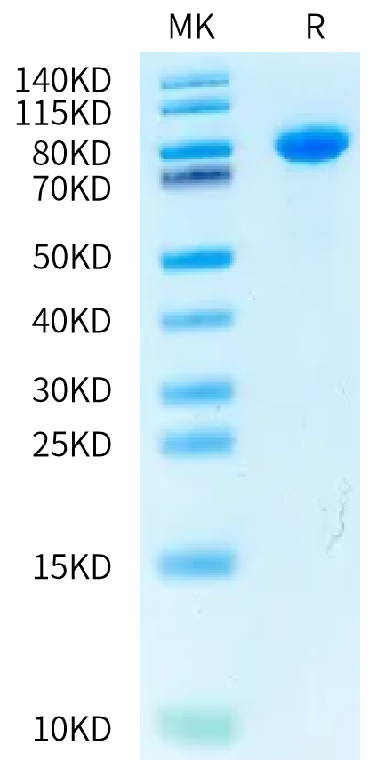 Rabbit Coagulation factor XI on Bis-Tris PAGE under reduced condition. The purity is greater than 95%.Recombinant Rabbit Coagulation factor XI Protein, Active