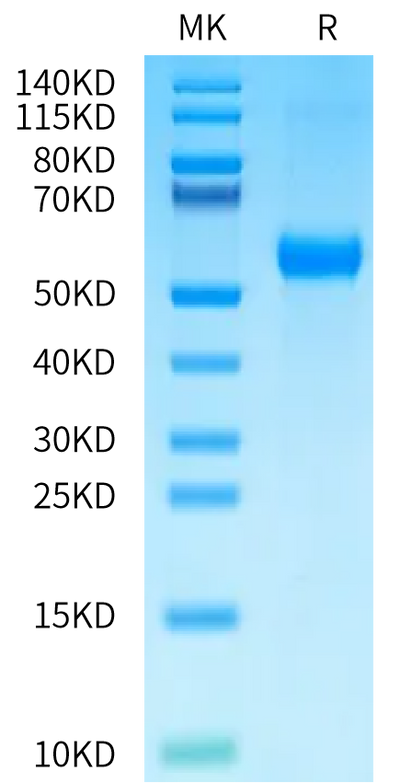 Human BMPR1A on Bis-Tris PAGE under reduced condition. The purity is greater than 95%.Recombinant Human BMPR1A/ALK-3 Protein