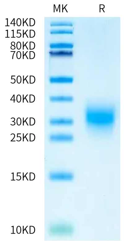 Human BMPR1A on Bis-Tris PAGE under reduced condition. The purity is greater than 95%.Recombinant Human BMPR1A/ALK-3 Protein
