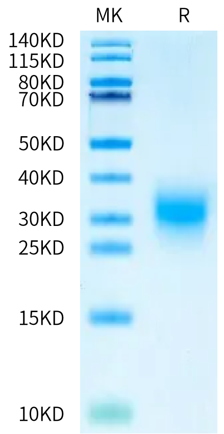 Human BMPR1A on Bis-Tris PAGE under reduced condition. The purity is greater than 95%.Recombinant Human BMPR1A/ALK-3 Protein