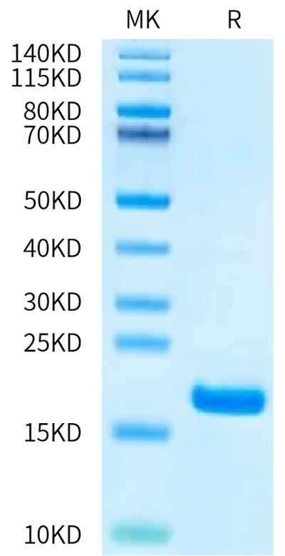 Human FGF1 on Bis-Tris PAGE under reduced condition. The purity is greater than 95%.Recombinant Human FGF1 Protein, Active