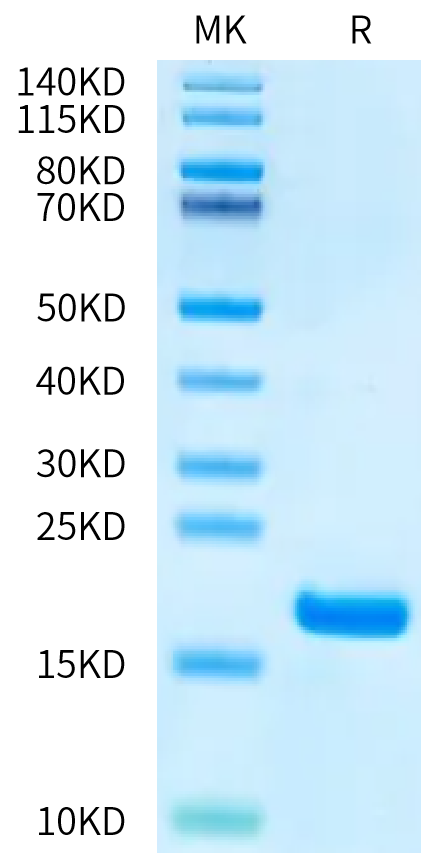 Human FGF1 on Bis-Tris PAGE under reduced condition. The purity is greater than 95%.Recombinant Human FGF1 Protein, Active