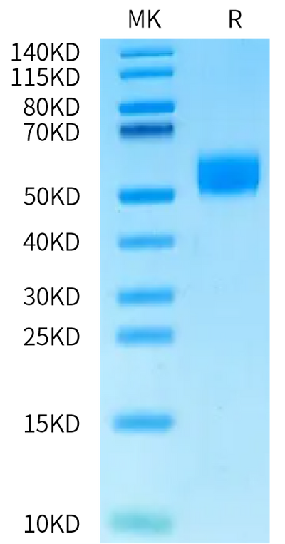 Human CDH17 Domain 3 on Bis-Tris PAGE under reduced condition. The purity is greater than 95%.Recombinant Human CDH17/Cadherin 17 Domain 3 Protein, Active