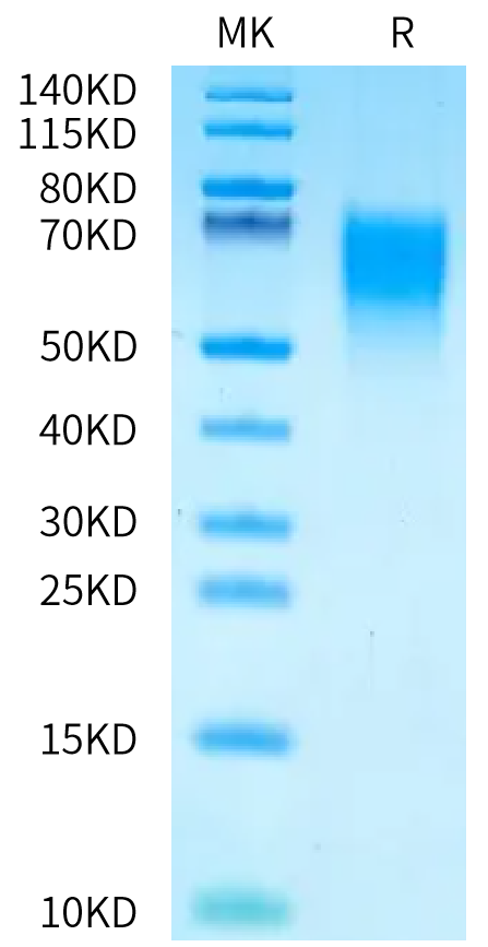 Human MICA*010:01:06 on Bis-Tris PAGE under reduced condition. The purity is greater than 95%.Recombinant Human MICA*010:01:06 Protein