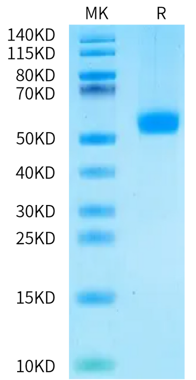 Human CDH17 Domain 2 on Bis-Tris PAGE under reduced condition. The purity is greater than 95%.Recombinant Human CDH17/Cadherin 17 Domain 2 Protein