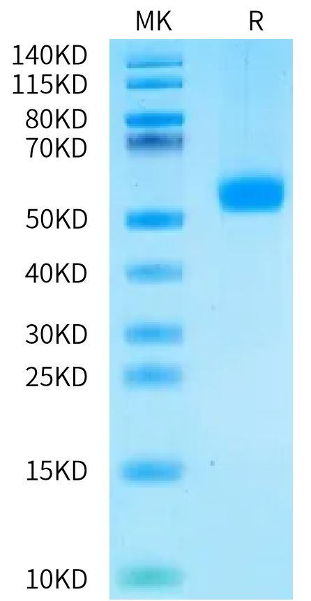 Human CDH17 Domain 2 on Bis-Tris PAGE under reduced condition. The purity is greater than 95%.Recombinant Human CDH17/Cadherin 17 Domain 2 Protein