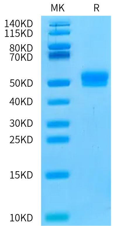 Human CDH17 Domain 4 on Bis-Tris PAGE under reduced condition. The purity is greater than 95%.Recombinant Human CDH17/Cadherin 17 Domain 4 Protein