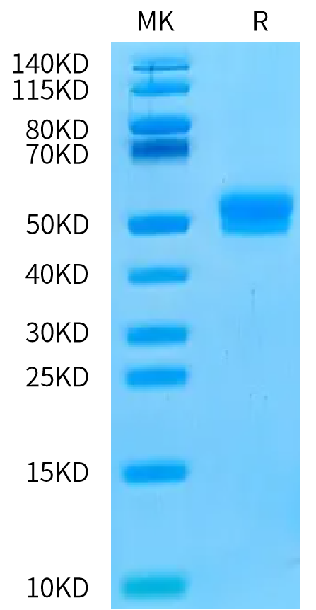 Human CDH17 Domain 4 on Bis-Tris PAGE under reduced condition. The purity is greater than 95%.Recombinant Human CDH17/Cadherin 17 Domain 4 Protein