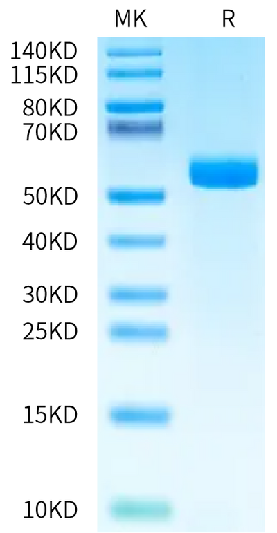 Biotinylated Human DLL3 on Bis-Tris PAGE under reduced condition. The purity is greater than 95%.Biotinylated Human DLL3 Protein, Active
