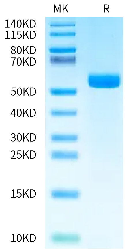 Biotinylated Human DLL3 on Bis-Tris PAGE under reduced condition. The purity is greater than 95%.Biotinylated Human DLL3 Protein, Active